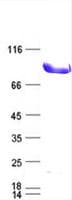 Human DYRK / DYRK1A Protein (Recombinant DDK,C-terminus)