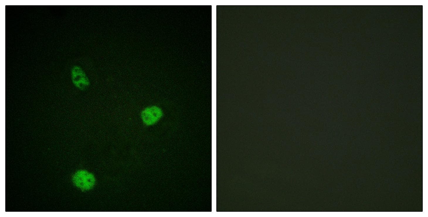 MITF Antibody (p180/73)