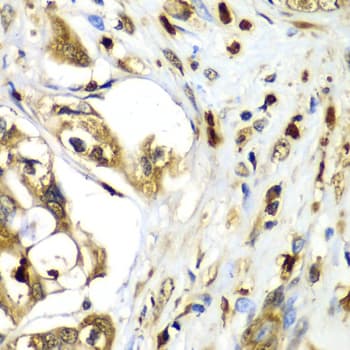 Polyclonal Rabbit anti-Human TMOD4 Antibody (IHC, IF, WB)