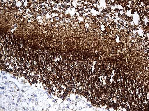 DBN1 / Drebrin Antibody (aa2-240, clone OTI4G4)