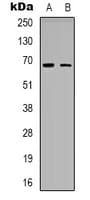 Polyclonal Rabbit anti-Human ME3 Antibody (C-Terminus, IHC, WB)