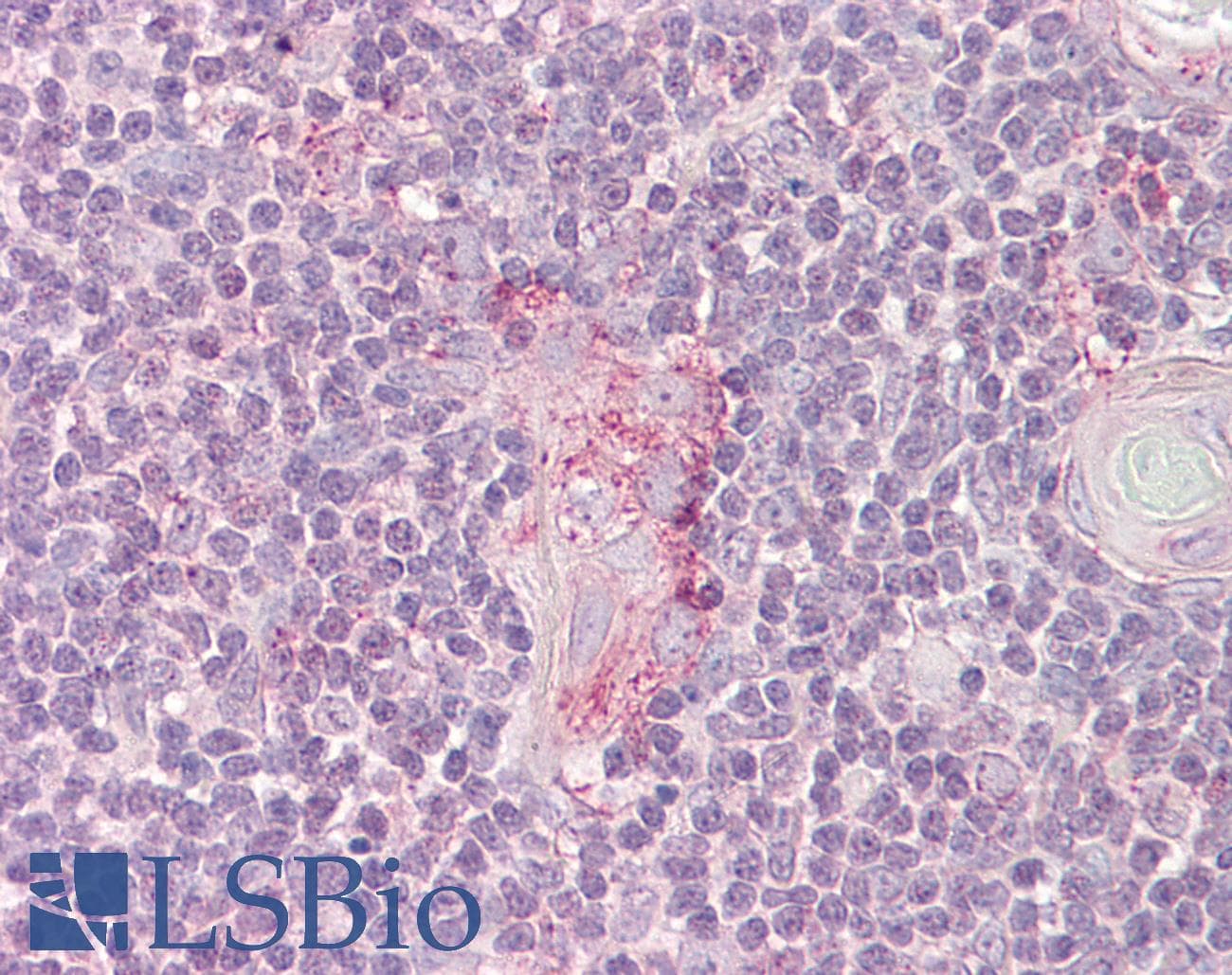 IHC-plus™ LYN Antibody (aa39-58)