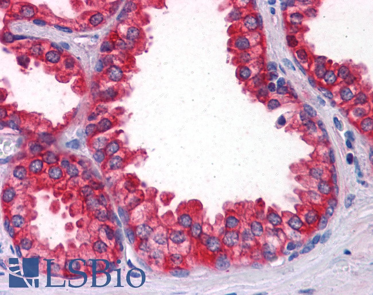 IHC-plus™ CORO1B Antibody (clone 1E7)