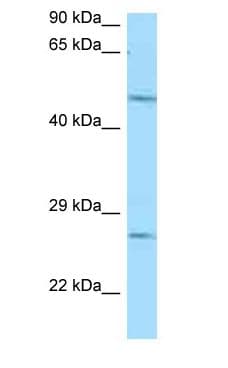 CD39 Antibody (aa49-98)