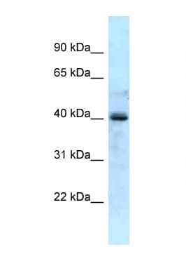 GALK1 / GK1 Antibody (aa57-106)