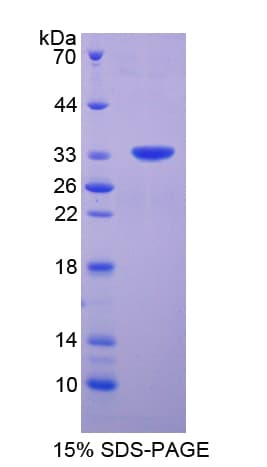 Human MTOR Protein (Recombinant His-T7)