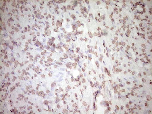 PLAT / TPA Antibody (aa157-426, clone OTI3H3, Carrier-free)