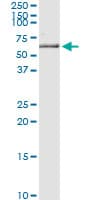 KRT5 / CK5 / Cytokeratin 5 Antibody (clone 1A12)