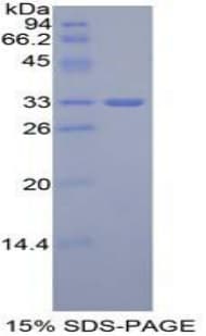 Mouse GLI3 Protein (Recombinant His-T7)
