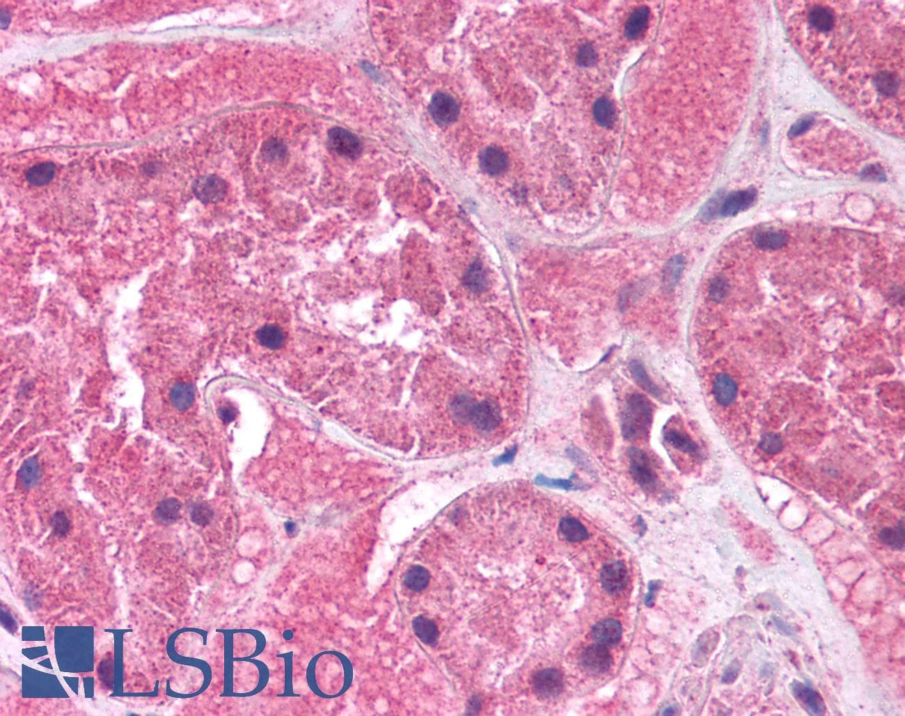 Polyclonal Rabbit anti-Human KCNAB2 / Kv-Beta-2 Antibody (aa121-170, IHC, WB)