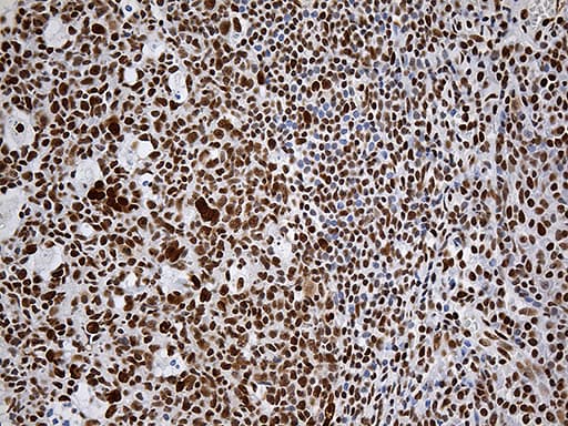 Monoclonal Mouse anti-Human RING1 Antibody (clone OTI11G7, aa88-362, IHC, WB)
