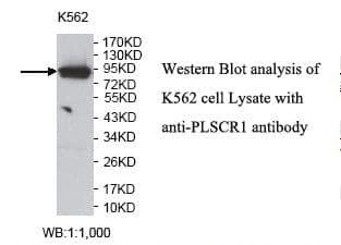 STAT5A Antibody (aa562-774)