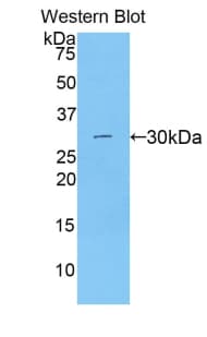 CTNNB1 / Beta Catenin Antibody (aa508-762)