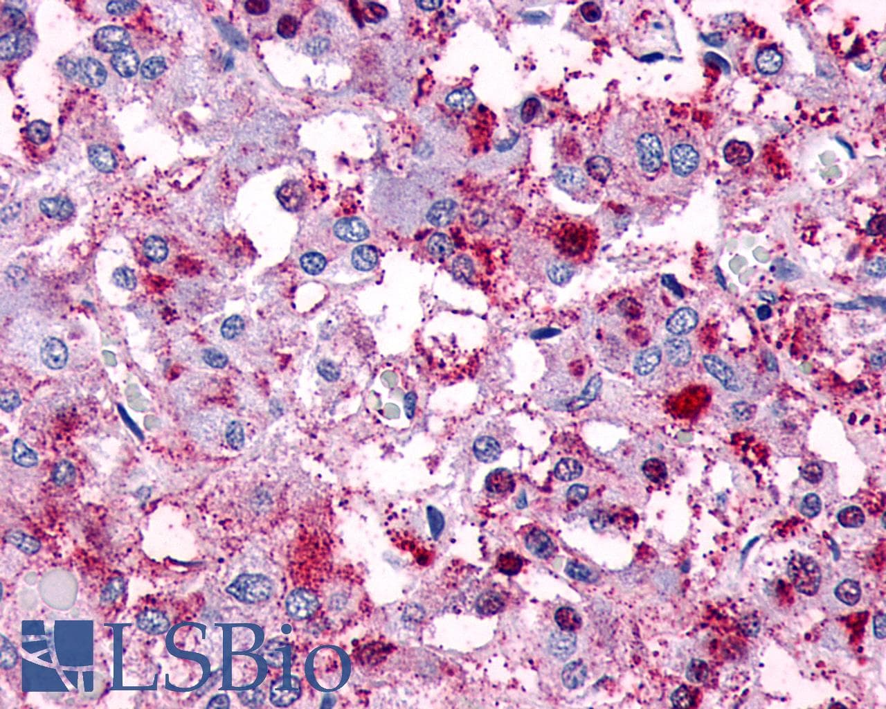 PathPlus™ Polyclonal Rabbit anti-Human VIPR1 Antibody (Cytoplasmic Domain, IHC)