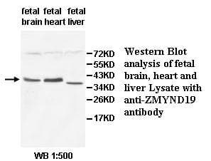 ZMYND19 Antibody (aa1-227)