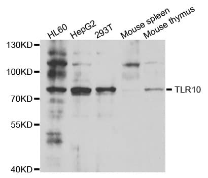 Polyclonal Rabbit anti-Human TLR10 Antibody (IHC, WB)