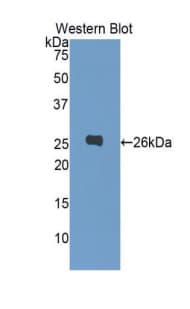 PCSK9 Antibody (aa454-679, PE)