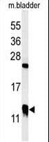 IHC-plus™ CRIP1 Antibody (aa48-77)
