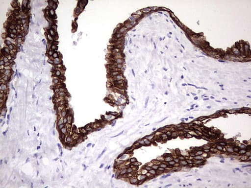 Monoclonal Mouse anti-Human KRT19 / CK19 / Cytokeratin 19 Antibody (clone OTI1F5, aa240-390, IHC, WB)