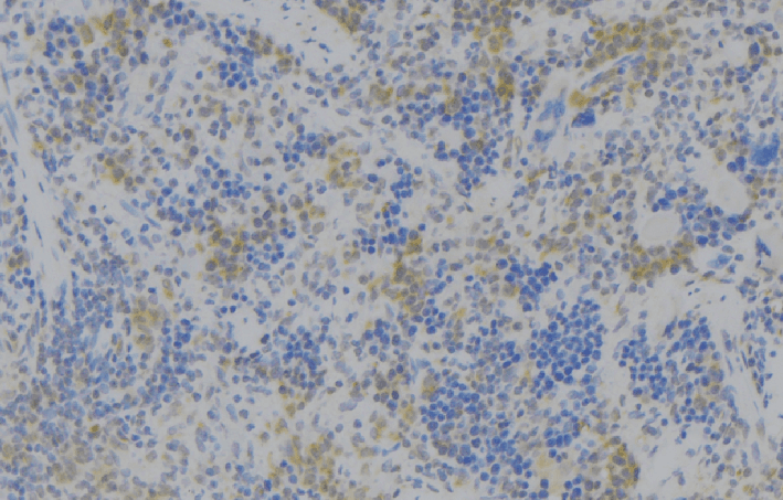 NOX3 Antibody