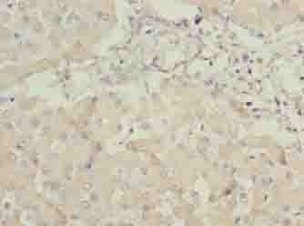 ANKRA2 / ANKRA Antibody