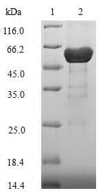 Neisseria meningitidis porB Protein (Recombinant 6His-SUMO, N-terminus)