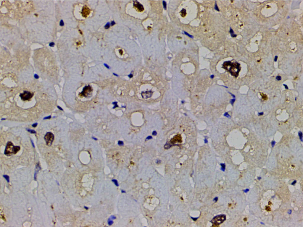 LIMK1 / LIMK Antibody (phospho-Thr508)