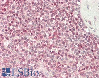 IHC-plus™ ETS1 / ETS-1 Antibody