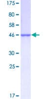 Human NDUFAB1 / ACP Protein (Recombinant GST)