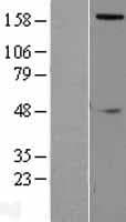 Human SLIT2 Protein (Over-Expression Lysate Myc-DDK (Flag))