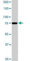 PIK3R1 / p85 Alpha Antibody (clone 3C11)
