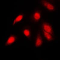 RELA / NFKB p65 Antibody (phospho-Ser311)