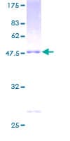Human RGS1 Protein (Recombinant GST)
