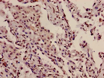 Polyclonal Rabbit anti-Human HIST1H3A Antibody (IHC, IF, WB)