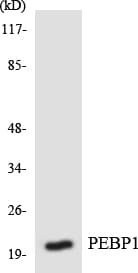PEBP1 / RKIP Antibody (aa89-138)
