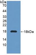 Mouse IL6R / IL6 Receptor Protein (Native His, N-Terminal)