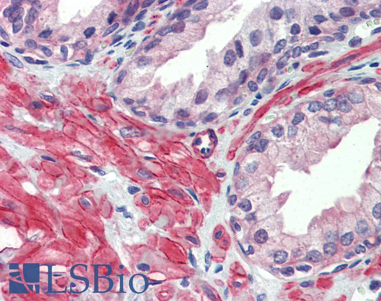 IHC-plus™ Polyclonal Rabbit anti-Human HTR2C / 5-HT2C Receptor Antibody (IHC, WB)