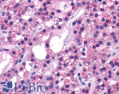 PathPlus™ Polyclonal Rabbit anti-Human CASR/Calcium Sensing Receptor Antibody (N-Terminus, IHC)