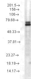IHC-plus™ HSP70 / Heat Shock Protein 70 Antibody (clone 3A3)