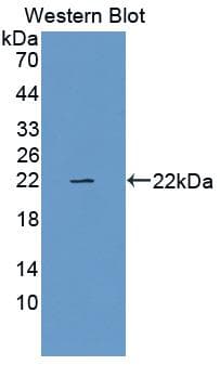 RLN1 / Relaxin Antibody (aa23-186)