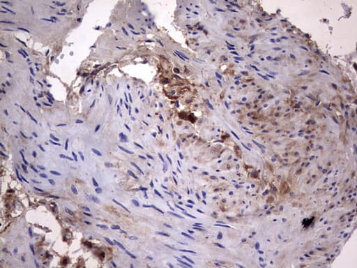 LGALS3 / Galectin 3 Antibody (clone OTI1C7)