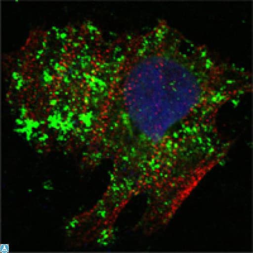 BCL10 / BCL-10 Antibody
