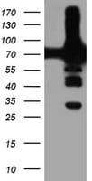 PFKP Antibody (clone OTI2E8, Carrier-free)