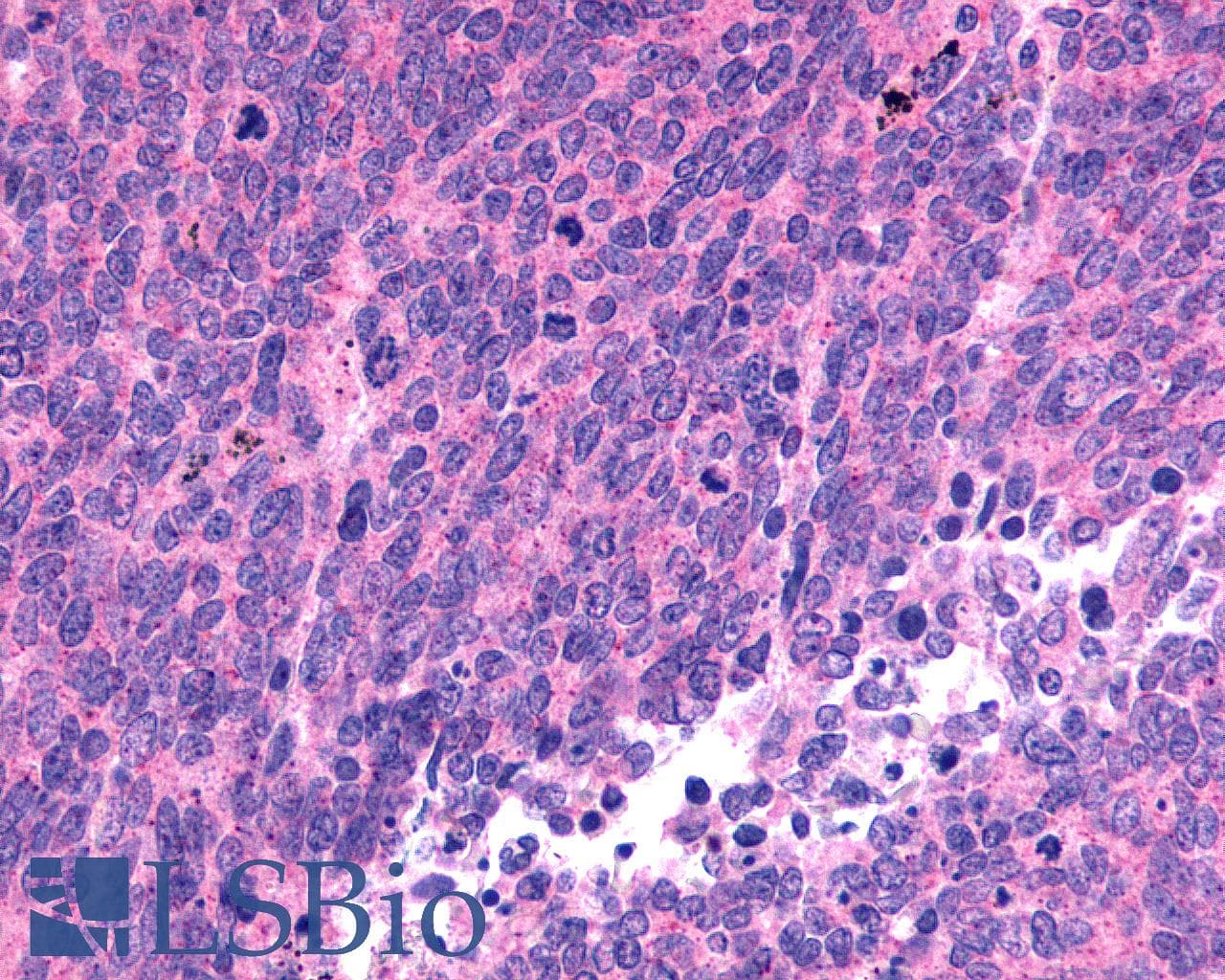 PathPlus™ Polyclonal Rabbit anti-Human SSTR1 Antibody (C-Terminus, IHC)