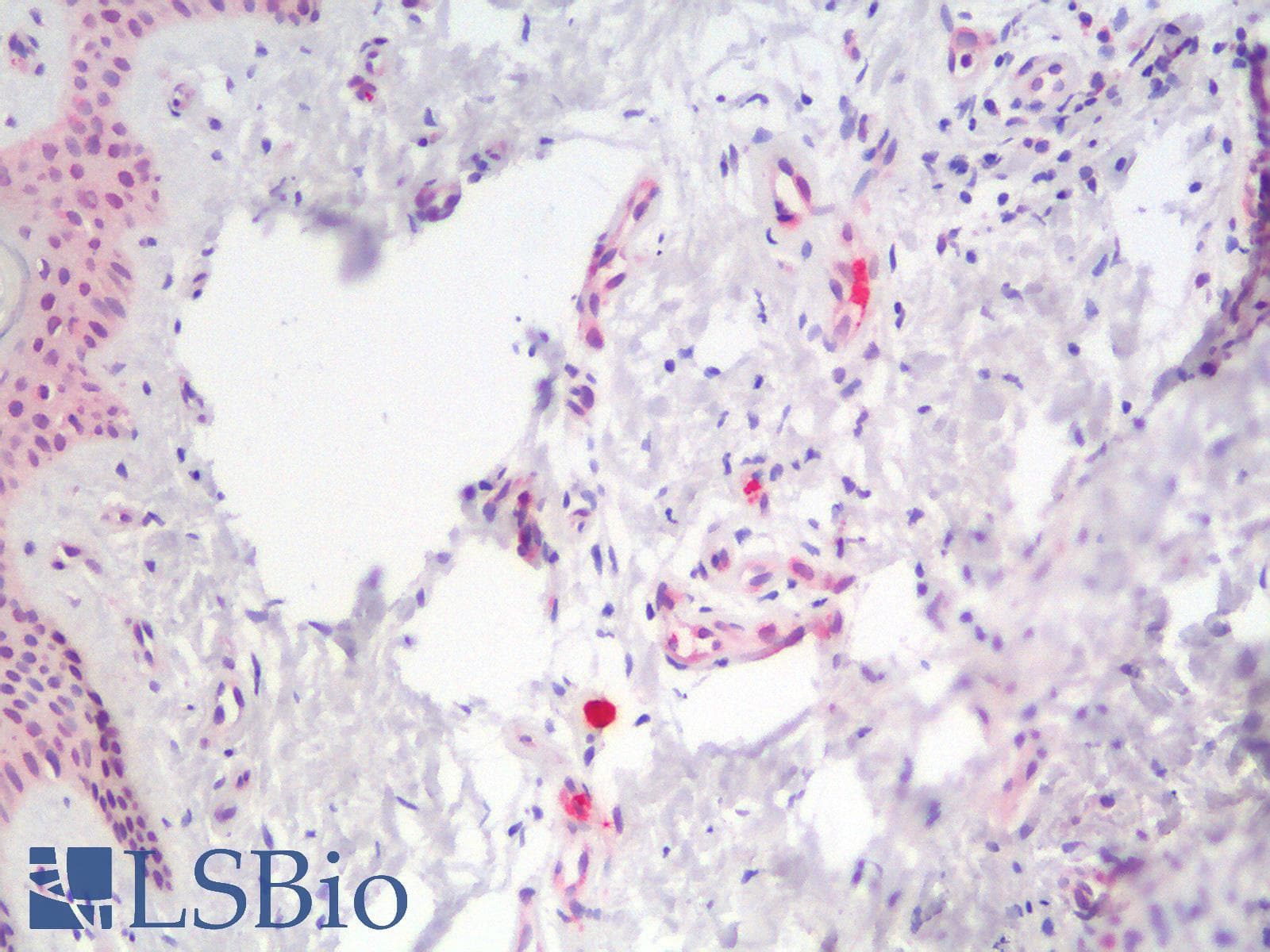IHC-plus™ NFKBIA / IKB Alpha / IKBA Antibody