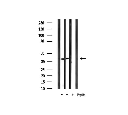 NFKBIA / IKB Alpha / IKBA Antibody (phospho-Tyr305)