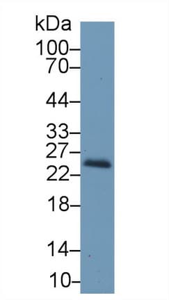 RBP4 Antibody (aa63-245, PE)