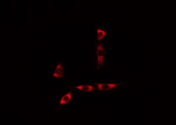 CYB5A / Cytochrome b5 Antibody