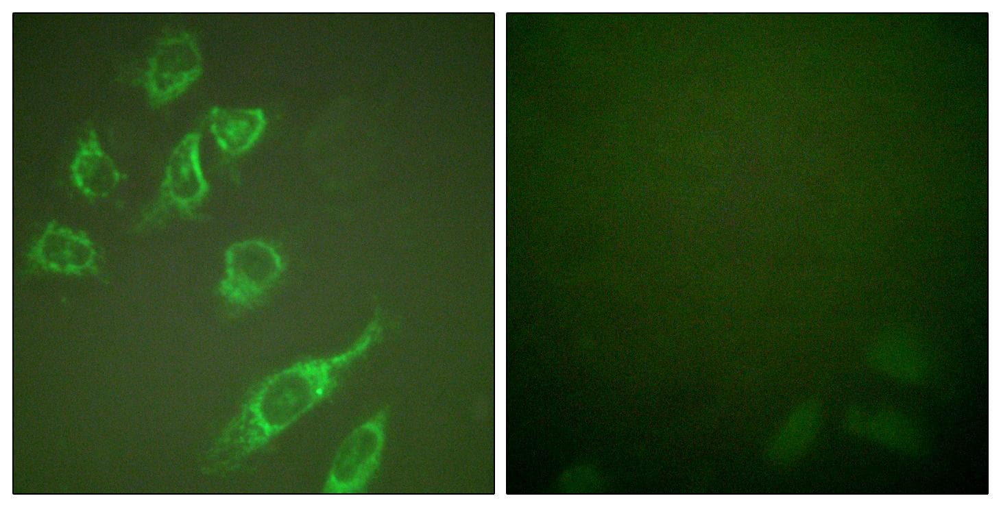 HOXA11+HOXD11 Antibody