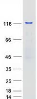Human PUM2 Protein (Recombinant Myc-DDK (Flag))